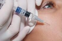 Postup biorevitalizácie