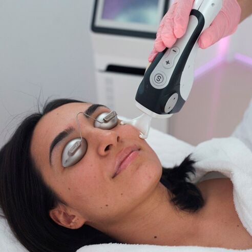 Ošetrenie pokožky tváre frakčným laserom